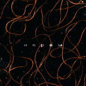 Лучнадежды</span> - Нервы